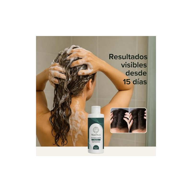 Shampoo Capilar Alquitrán Psoriasis, Caspa Matimati 425ml