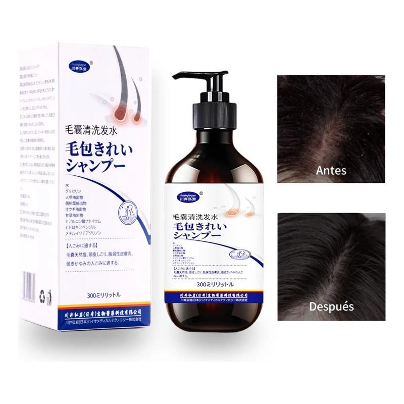 Shampoo Limpiador Para Folículos Pilosos Elimina Caspa Ypico
