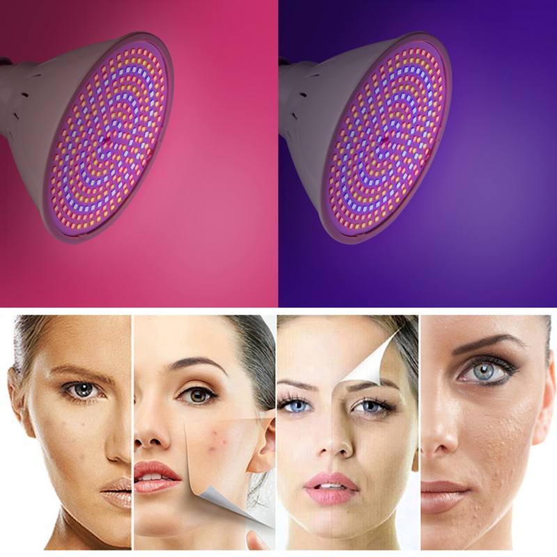3 Colors LED Skin Rejuvenation Light Professional Acne Wrinkle Removal