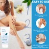 VenoFIT Cream for Varicose Veins, Venous Circulation Disorders, Brittle Capillaries,