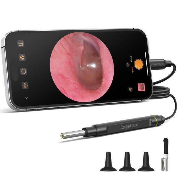 ScopeAround Otoscope Ear Camera, Ear Wax Removal Tool 1080P FHD