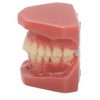 Tooth Model 28 Teeth Dental Orthodontic Model Teaching Study Supplies