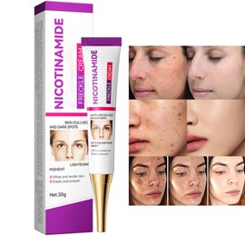 Dark Spot Remover for Face and Body, Dark Spot Corrector Serum - Advanced Melasma Treatment, Sun Spot, Age Spot, Brown Spot Reduce for Men, Women - 20mL