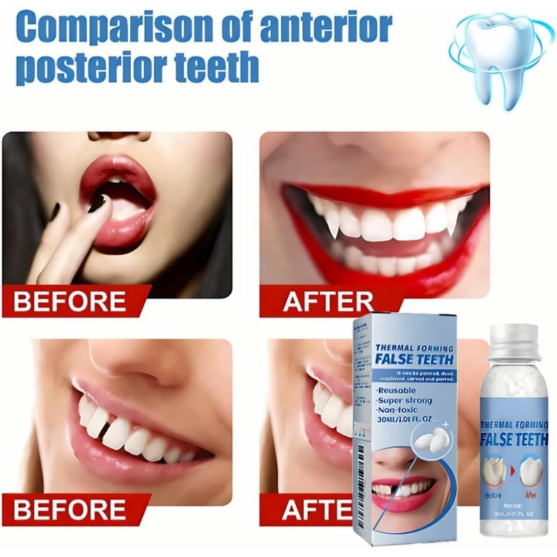 Fake Tooth Repair kits for Filling The Missing Broken Tooth