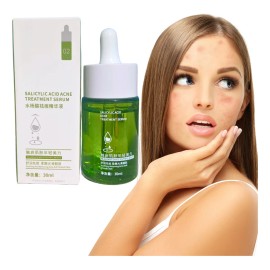 Suero Facial Contra Acn Acido Saliclico Tratamiento 30ml F Momento De Aplicacin Danoche Tipo De Piel Acneica                                          