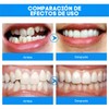 Protector Bucal Alineación Mandíbula Corrección Dental Anti Ronquidos Moldeable Con
