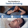 ProDental Thin and Trim Anti Grinding, Teeth Whitening Mouth Guard,