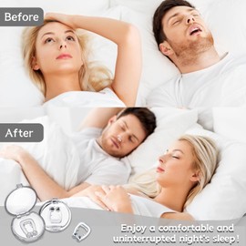 8er-Pack Anti-Schnarch-Geräte, Schnarchstopper, Schnarch-Nasenklammer, Anti-Schnarch-Nasenklammer, Anti-Schnarch-Nasen-Schnarch-Clip, Schnarchhilfen für Damen und Herren (transparent)