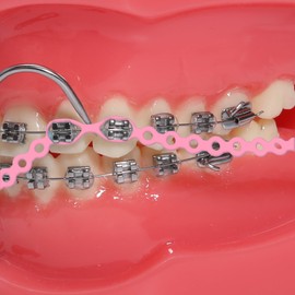 faruijie Colourful Elastic Power Chain for Braces Dental Orthodontic Powerchains 3 Sizes Ortho Rubber Band(Continuous,Pink 20#)