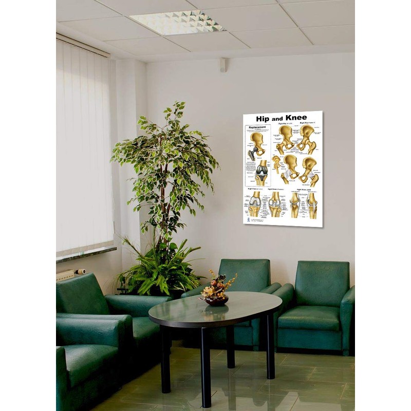 Hip and Knee Anatomical Poster, size 24Wx36T
