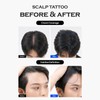 [Forbeaut] Scalp Tattoo – Black Hairline Filler for Thinning Spots