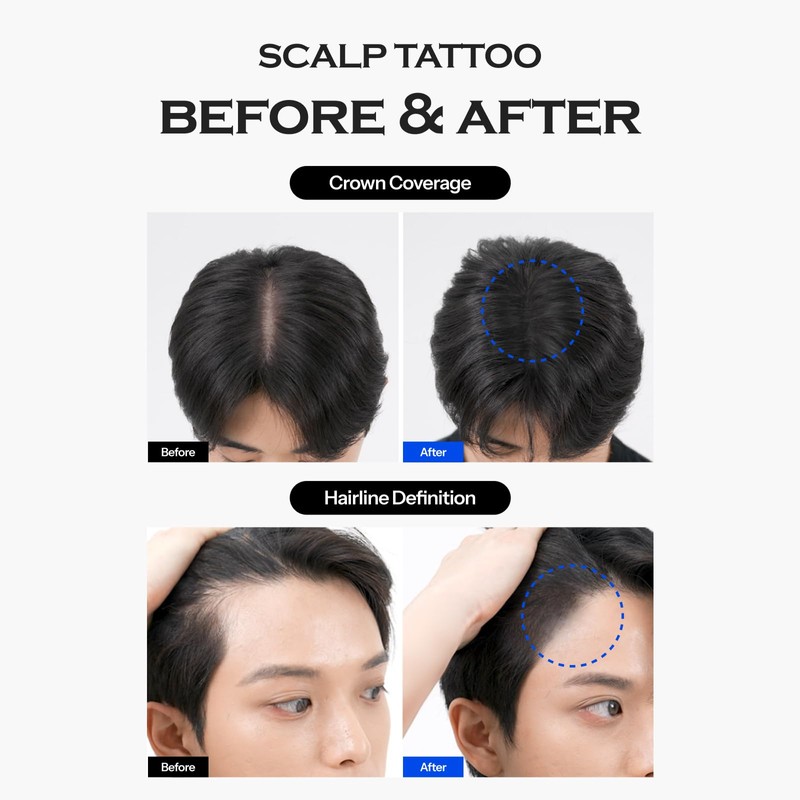 [Forbeaut] Scalp Tattoo – Black Hairline Filler for Thinning Spots