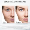 Kit Soluciones Hydrafacial As1 Sa2 Ao3 Hydradermabrasion