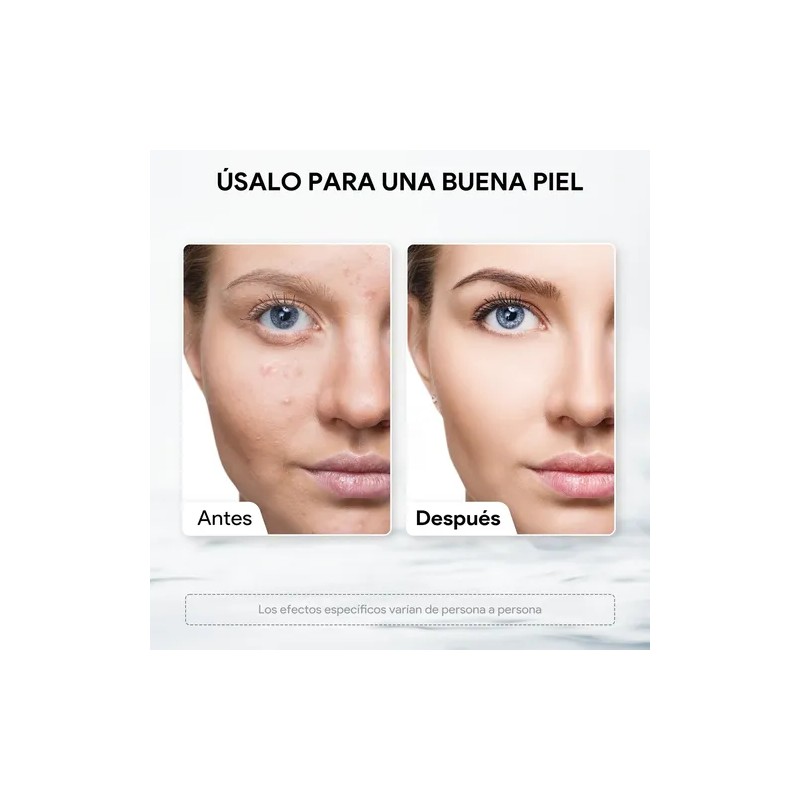 Kit Soluciones Hydrafacial As1 Sa2 Ao3 Hydradermabrasion