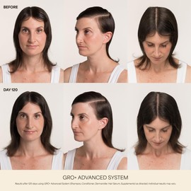 GRO+ Advanced Hair Growth and Density Supplements