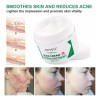 Crema Para Cicatrices, Estrías, Acné, Cacarizos Crema Repara