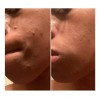 Urban Skin Rx 3-in-1 Clear Skin Cleansing Bar - 2.0oz