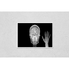 Poster Reproduction of Film X ray Radiograph Show Human Anatomy of Skull Bone and Skeleton which Skeletal Hand Show Sign of Saying Hello. Medical Imaging in Orthopedic and Radiology Concept