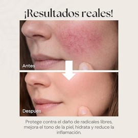 Sqin Luxiena Serum Baba de Caracol Coreano, Mucina de Caracol 96, Repara e Hidrata la piel, Skincare Coreano, Snail Mucin, 100 ml.                    