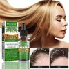 Aceite Natural de Romero para la Caída del Cabello Aceite