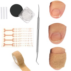 Ingrown Toenail Treatment, Removal Kit, 50pcs Transparent Ingrown Toenail Corrector Strips, 50pcs Toenail Corrector Patches, 1pcs Ingrown Toenail File And Lifter, 1 Roll of Glue-Free Toe Protector