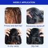 2 Pcs Anti-Dandruff Shampoo, Oil Control and Refreshing Formula, Hair