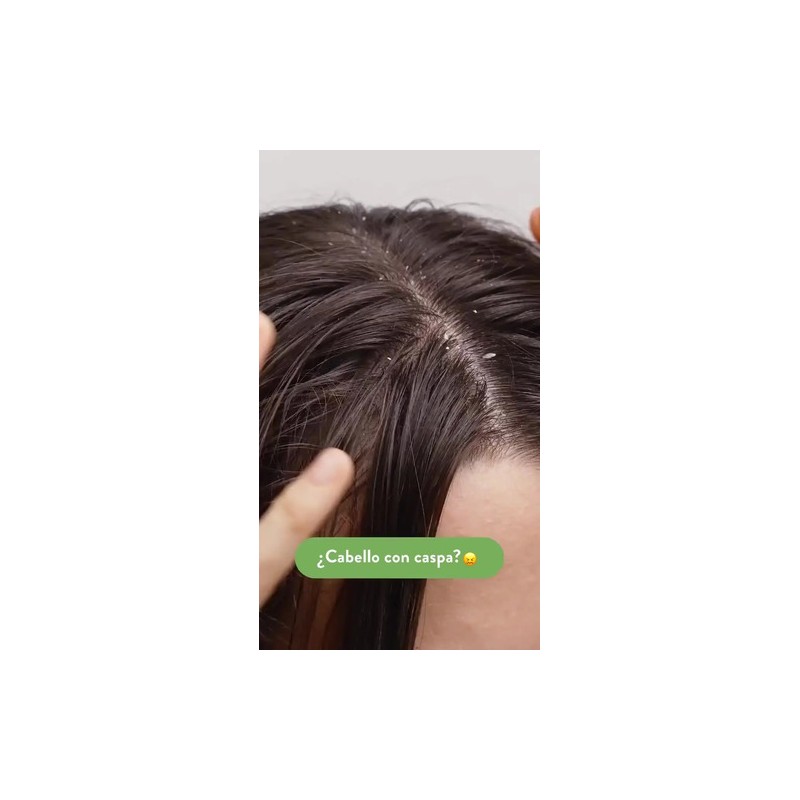Shampoo Natural Anticaspa Descamación Árbol Verde Canela Y Menta 500ml