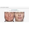 Brightener Anteage Md, Despigmentante Hiperpigmentada Noche