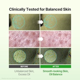 DERMA FACTORY Suero facial de niacinamida al 20% para piel grasa, cuidado de los poros | 1.01 fl oz, ligero, sin fragancia, cuidado de la piel coreano