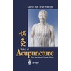 Basics of Acupuncture