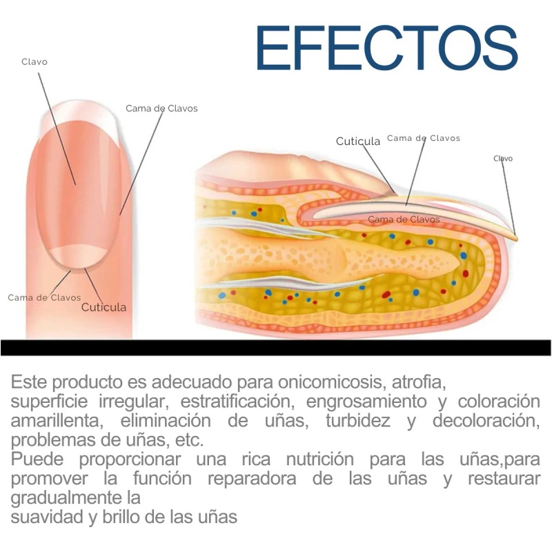 32 Parches Reparación Uñas + 1 Lampara Eliminar Hongos Pie