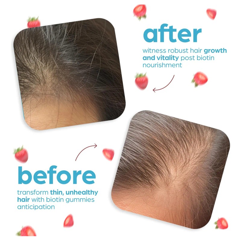 Artnaturals Gomitas Biotina 10000mcg - Crecimiento Cabello