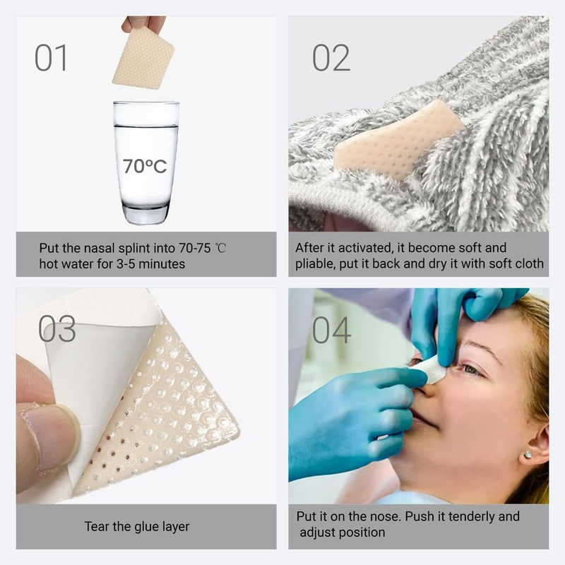 CHOYTONG Thermoplastic Nasal Splints - Nose External Support Protector for