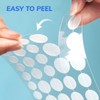 KOLZEMV Large Pimple Patches in 5 Sizes for Large Pimples,