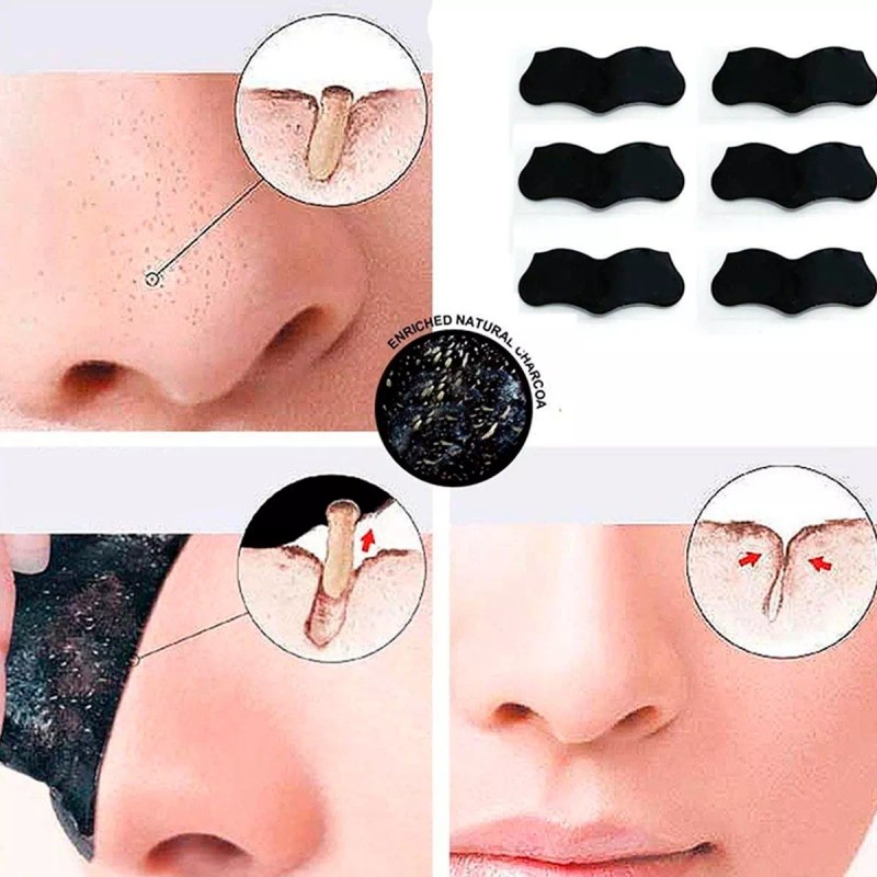 Veraly 100pcs Banda Elimina Puntos Negros Acné Espinillas Limpieza