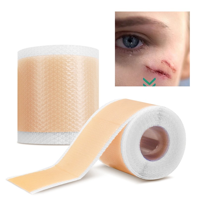 4.9ft 1.6in Scar Roll Silicone Scar Sheets Professional Scar Removal