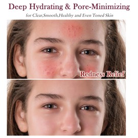 Skin Care Set,Women Teenage Skin Care Teens 10-12,Pore Minimizer Soothe,Hydrate,Oil Control,Women Teen Girls Skincare Facial Skin Care Products,Travel Facial Skin Care Routine Kit Beauty Gift Set