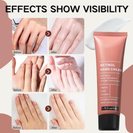 Reti-Nol Hand Cream,Hand Cream For Very Dry Ha-Nds,Anti Aging Ha-Nd Cre-Am,Reti-Nol Moisturising Cre-Am,Deep Nourishing,Non-Greasy,Moisturizer For Aging&Dry Cracked Ha-Nds,Protects Skin,Nails,Cuticles