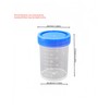15Pcs 1.35oz/40ml Sterile Specimen Cups,Each Sterile Specimen Cup has a