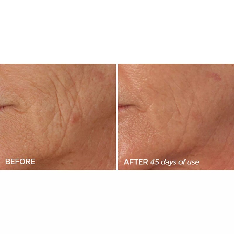 BEAUTYBIO Beauty Bioscience R45 The Reversal 2 Phase Retinol Treatment