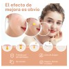 280pzs Mascarillas Estrella Acne