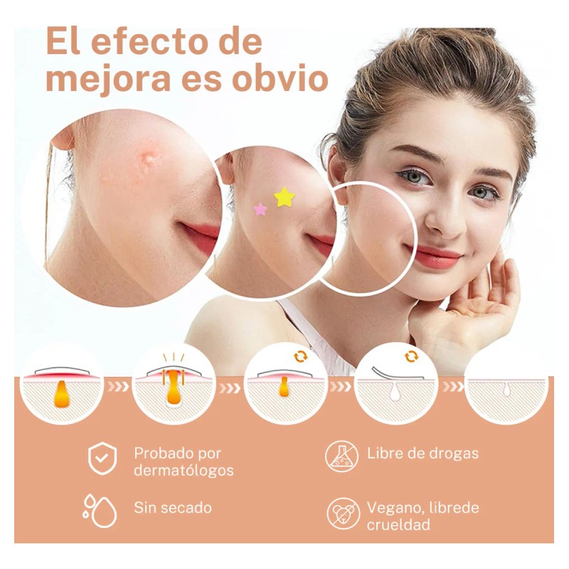 280pzs Mascarillas Estrella Acne