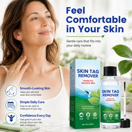 Skin Tag Remover 30ml, Fast-Acting Wart Remover, Gentle Formula & Natural Plant-Based Verruca Treatment for Hands, Face, Feet & Body, At-Home Solution for Adults & Kids