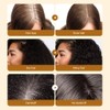 5X Batana Oil Serum Hair Growth For Healthier Thicker&Stronger Fuller