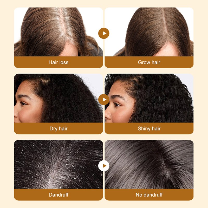 5X Batana Oil Serum Hair Growth For Healthier Thicker&Stronger Fuller
