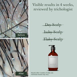 GOOD&ALL Tea Tree Shampoo for Dry Itchy Scalp with Peppermint - Sodium Lauryl Sulfate/Sulphate, Silicone, Paraben, Fragrance Free - 13.5 fl oz