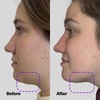 SickScience ShapeShift Jaw Defining Serum for Double Chin, Face &