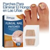 32 Parches Reparación Uñas + 1 Lampara Eliminar Hongos Pie