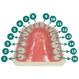 Typodont 860 Prep Replacement Teeth with Crowns and Cavities 5 Teeth per Reference (5 Pack) (#12 Cavity (5 Pack))
