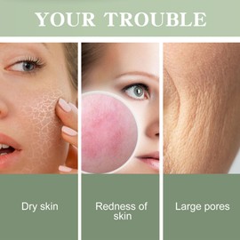 ARCHIDATE Tea Tree Serum for Face Acne, Breakout, Pimples, Deep Pore Cleaning, Oil Control, Shrink Pores, Non-Greasy Tea Tree Face Serum Sooth Skin, Enhances Skin Barrier (30ml)